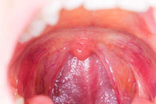 function of tonsils