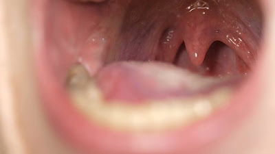 function of uvula