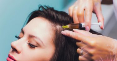 PRP Treatment For Hair Loss