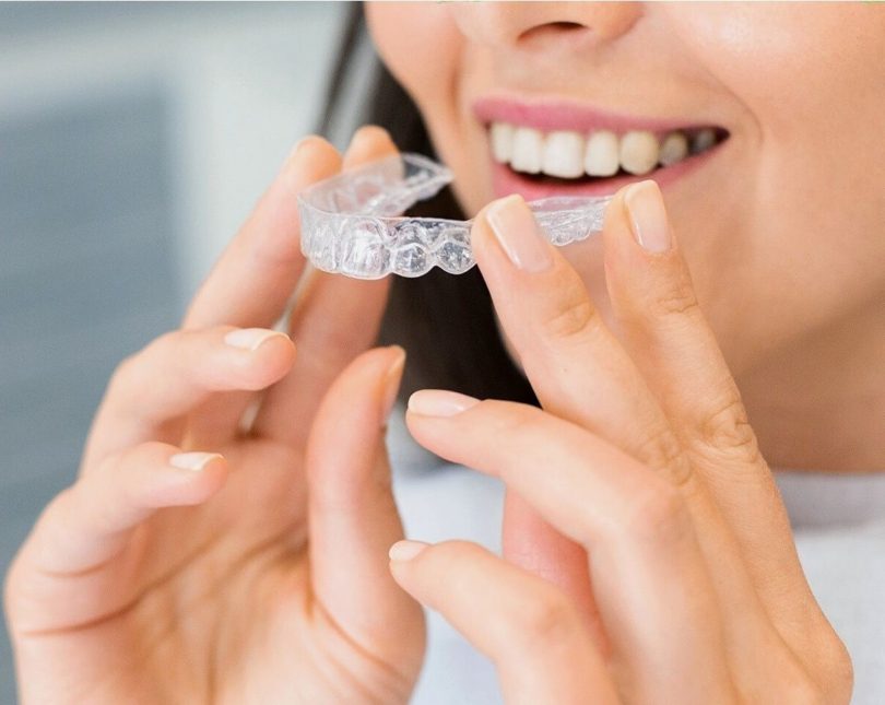 Dos & Don'ts of Cleaning Invisalign Aligners