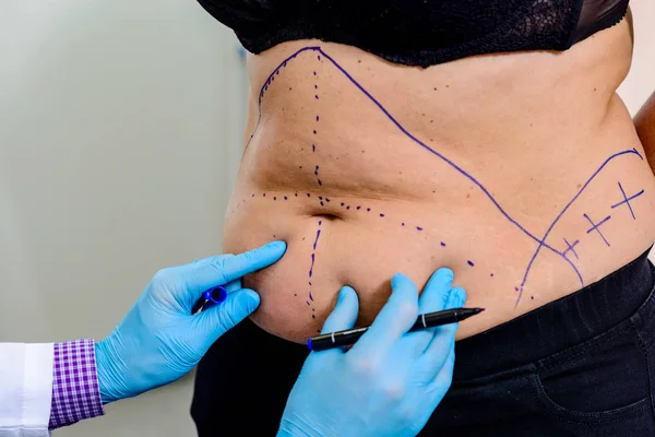 Exploring Non-Surgical Alternatives to Tummy Tucks: What’s New in Body Contouring?